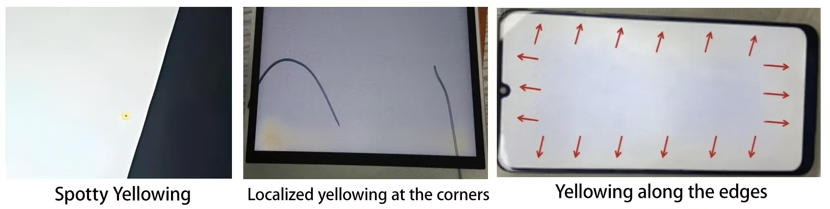 黄斑类别 黄斑类别