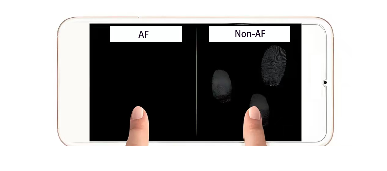 AF与非AF现象对比 AF与非AF现象对比